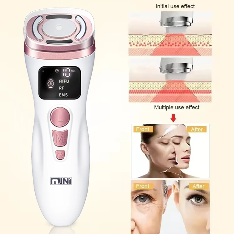 جهاز صغير HIFU بالموجات فوق الصوتية EMS جهاز تجميل الوجه مكركرنت لشد العناية بالبشرة أداة مضادة للتجاعيد للوجه