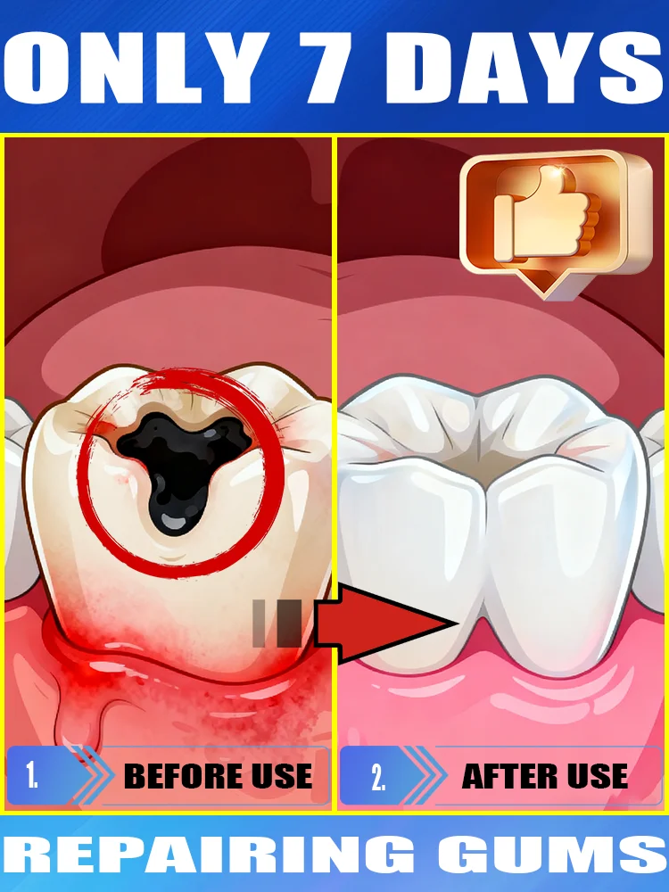 

Ежедневный уход за полостью рта может содержать восстановление полостей и предотвратить их.