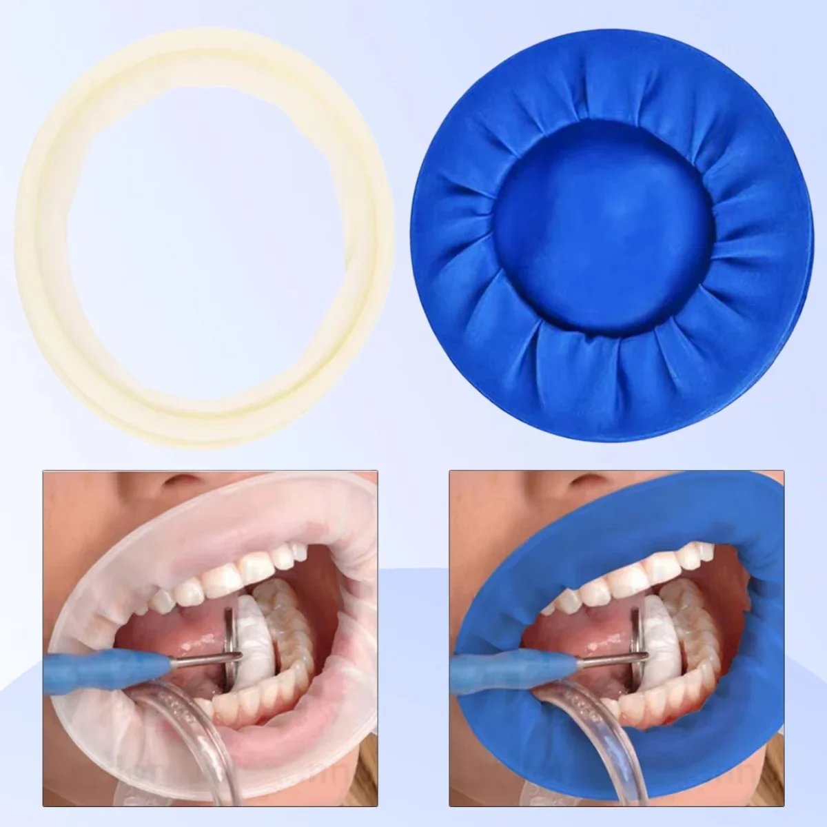 5 Pcs Rubber Dam Dental Mouth Opener Dentistry Cheek Retractors For Surgery O Shape Oral Hygiene Tooth Whitening Products
