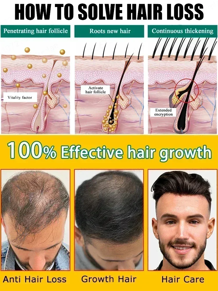 Fast Hair Growth Hair Growth Oil Effective Baldness Repair Hereditary Hair Loss Postpartum Seborrheic