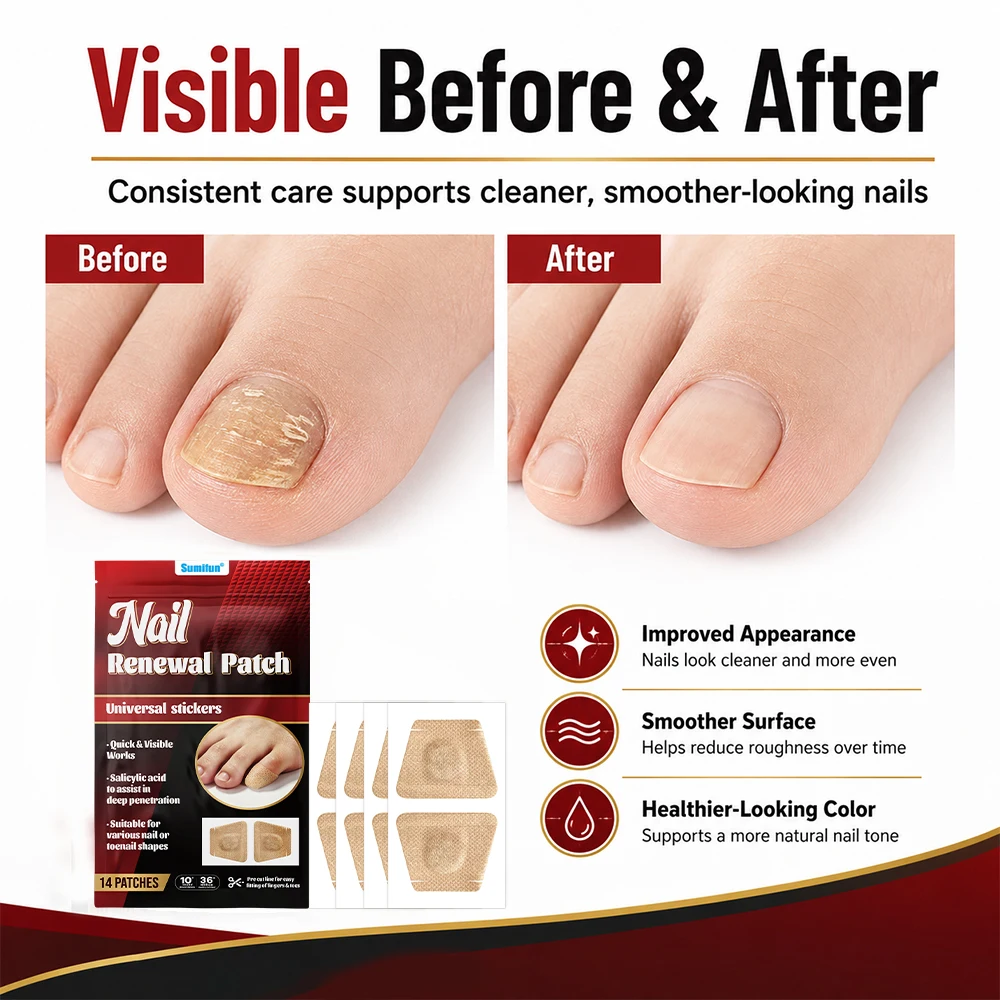 280/560Pcs 2Styles Nail Care Patch Nourishing Body Health Care