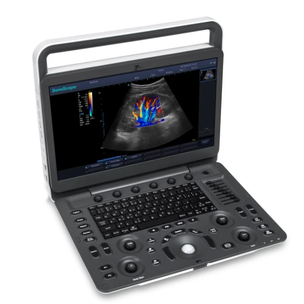 Products subject to negotiationFactory price of Medical Science Sonoscape E2 Pro Color Doppler Ultrasound More cost-effective