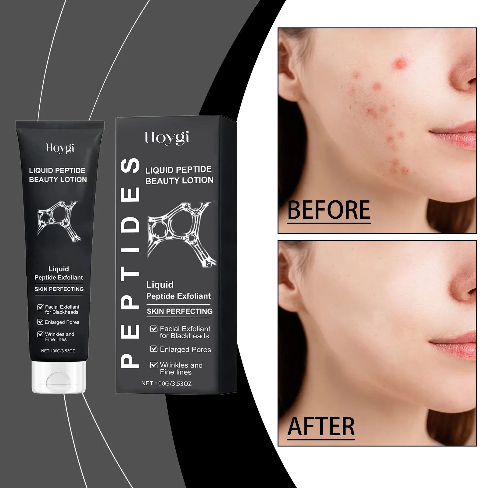 Lozione di bellezza peptidica liquida - Esfoliante peptidico per l'perfezionamento della pelle, esfoliazione delicata, 100 g