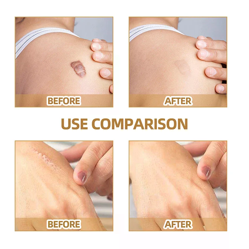 60Patch Waterproof Tattoo Flaw Conceal Tape Full Cover Concealer Sticker Body Arm Temporary Concealing Tattoo Scar Cover Sticker