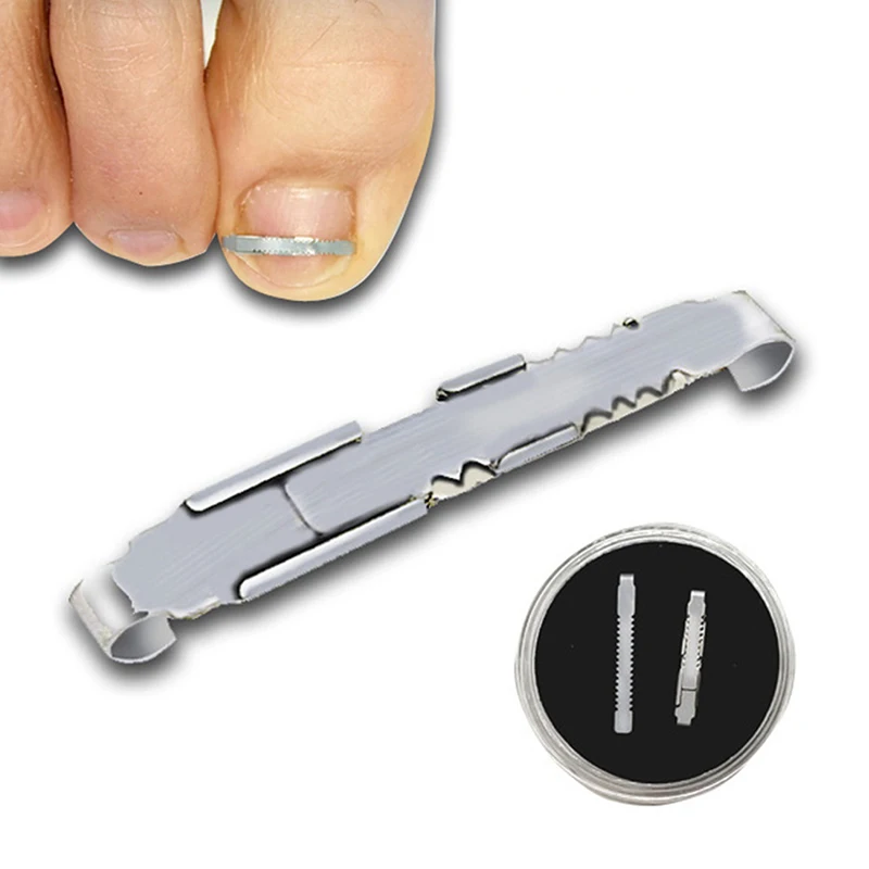 Ingrown Corrector unha para pedicure, Incorporar Toe Nail Treatment, Correção de unha engrown profissional, Pé Care Tool