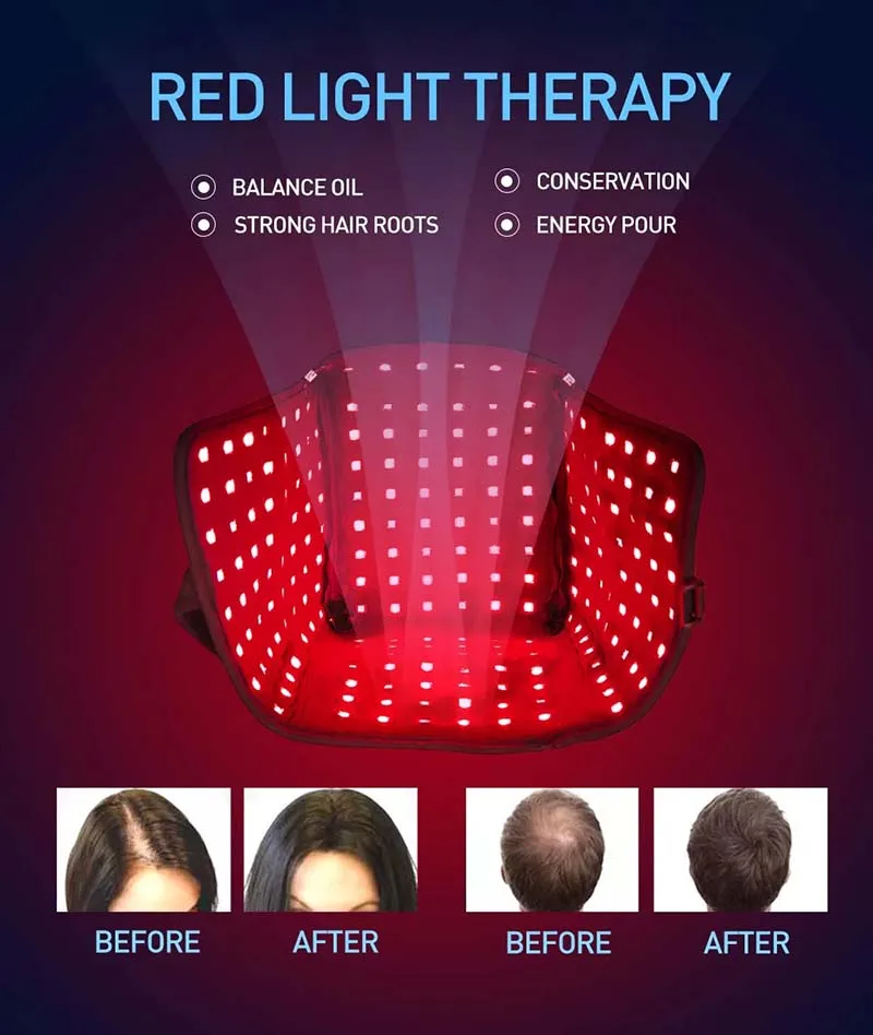 Scalp Relax Massager hat Hair Growth Cap LED Red Light Therapy cap Anti Hair Loss Anxiety Stress Relief Head Pain Hat