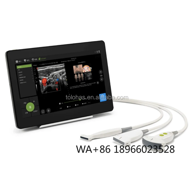 LHAPA3381 13.3 Inch Touch Screen Tablet Ultrasound/Portable Ultrasonic Diagnostic Devices/Color Doppler Ultrasound