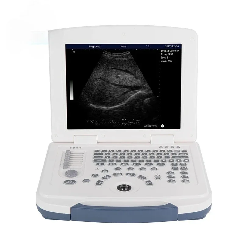 Veterinary Equipment MU10 Sonoscape Veterinary Ultrasound Machine