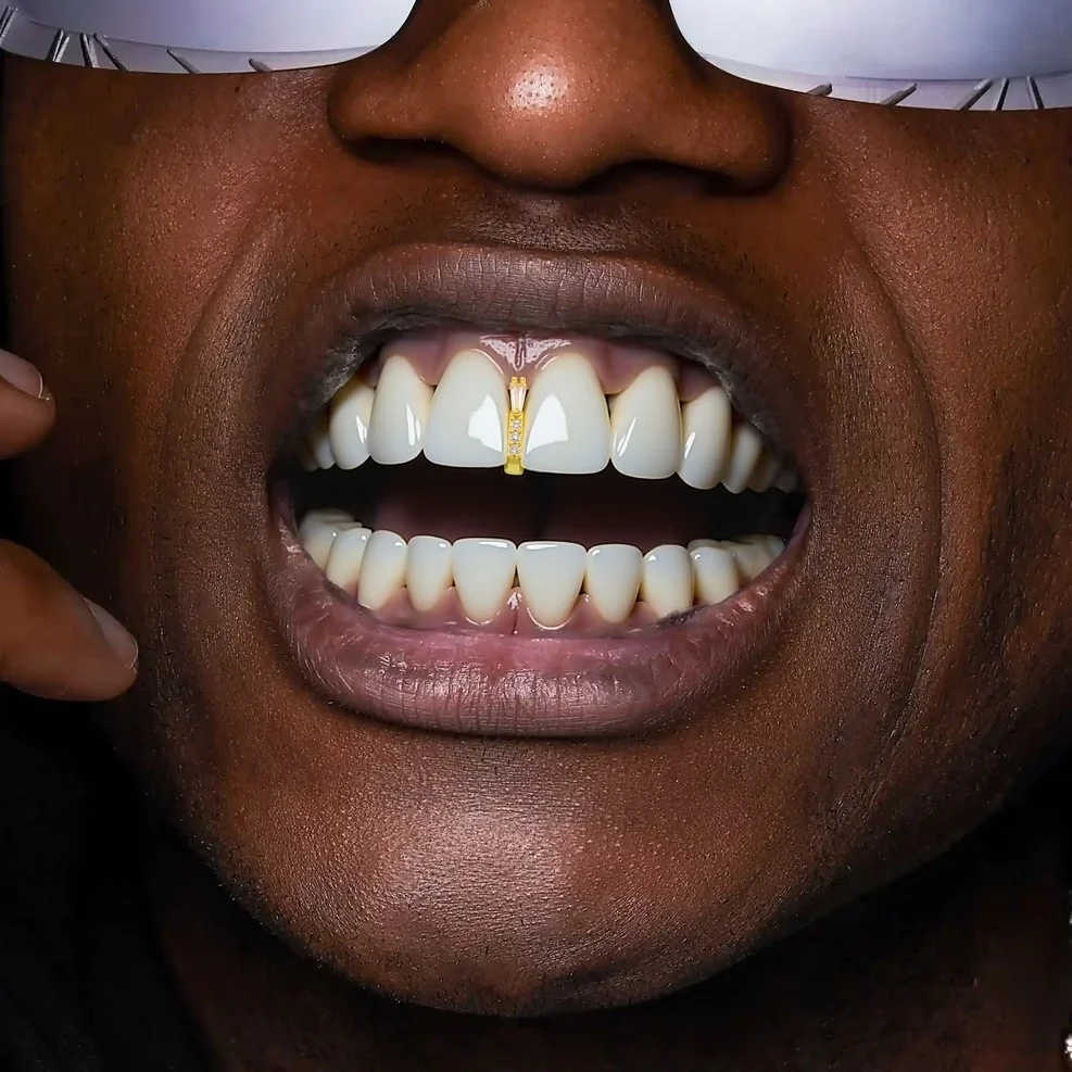 Zirconium Dental Braces With Numerous Long Prongs, Stylish Polygonal Dental Ornaments, Personalized Hip-Hop Dental Braces