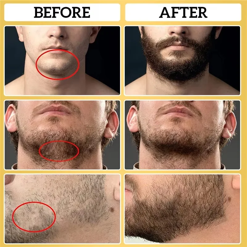 Fast Beard Growth Serum For Men Promote Beard Regrowth Thicker Longer Fuller Anti Hair Loss Essential Oil Hair Care Product