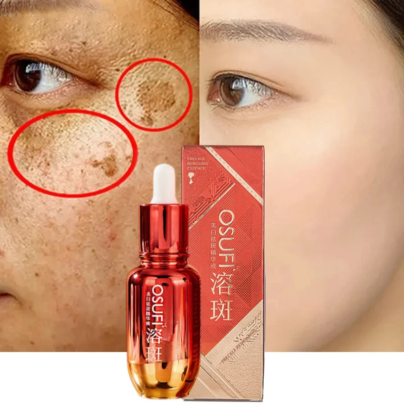 Freckle Removing Whitening Face Serum Black Spot Melasma Remover Reduce Pigmentation Moisturizing Brightening Skin Care 50ml