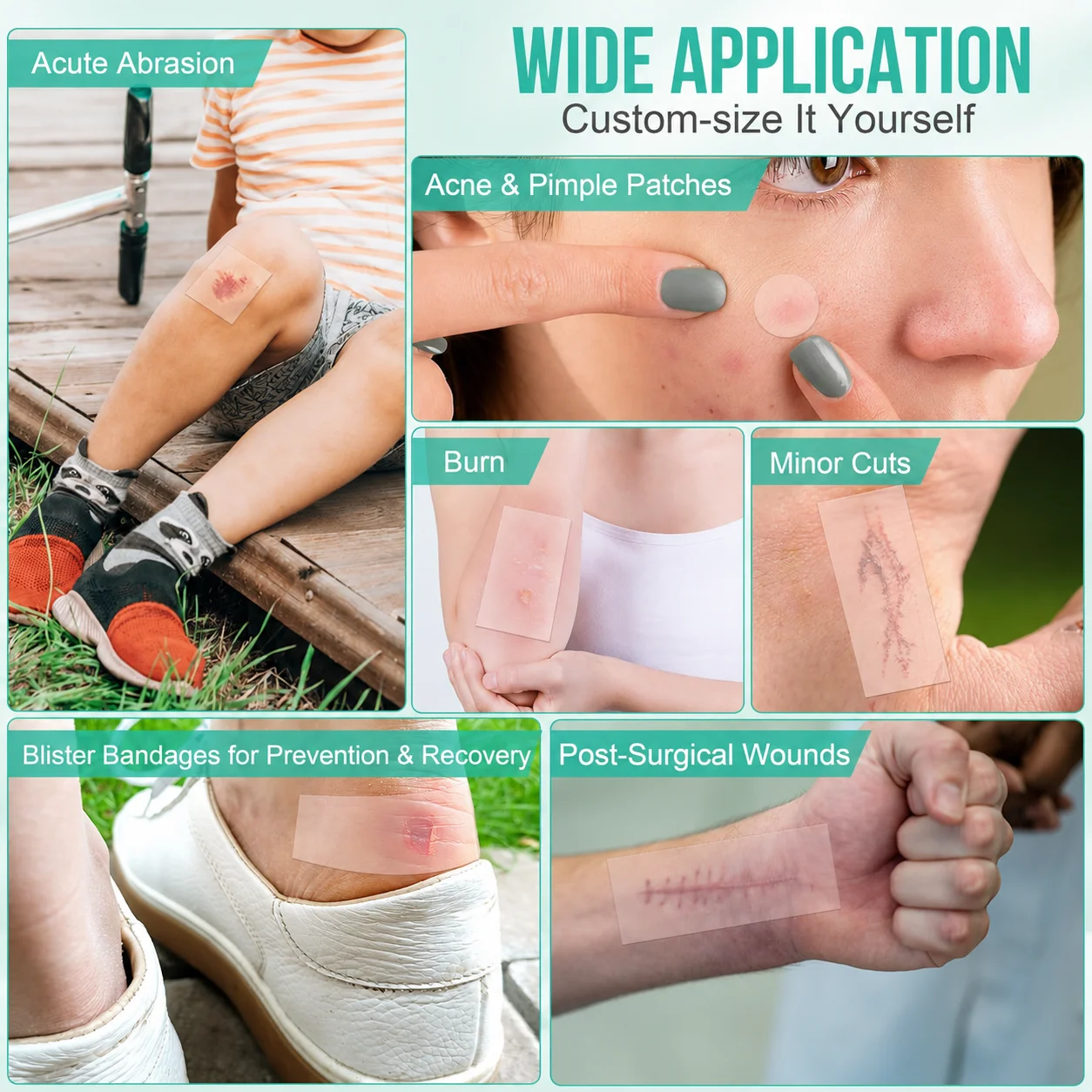 Pimple Patch Artificial Skin Wound Dressing Freely Cuttable Skin-Friendly Adhesive Keep Wound Clean 1 Roll Value Pack.