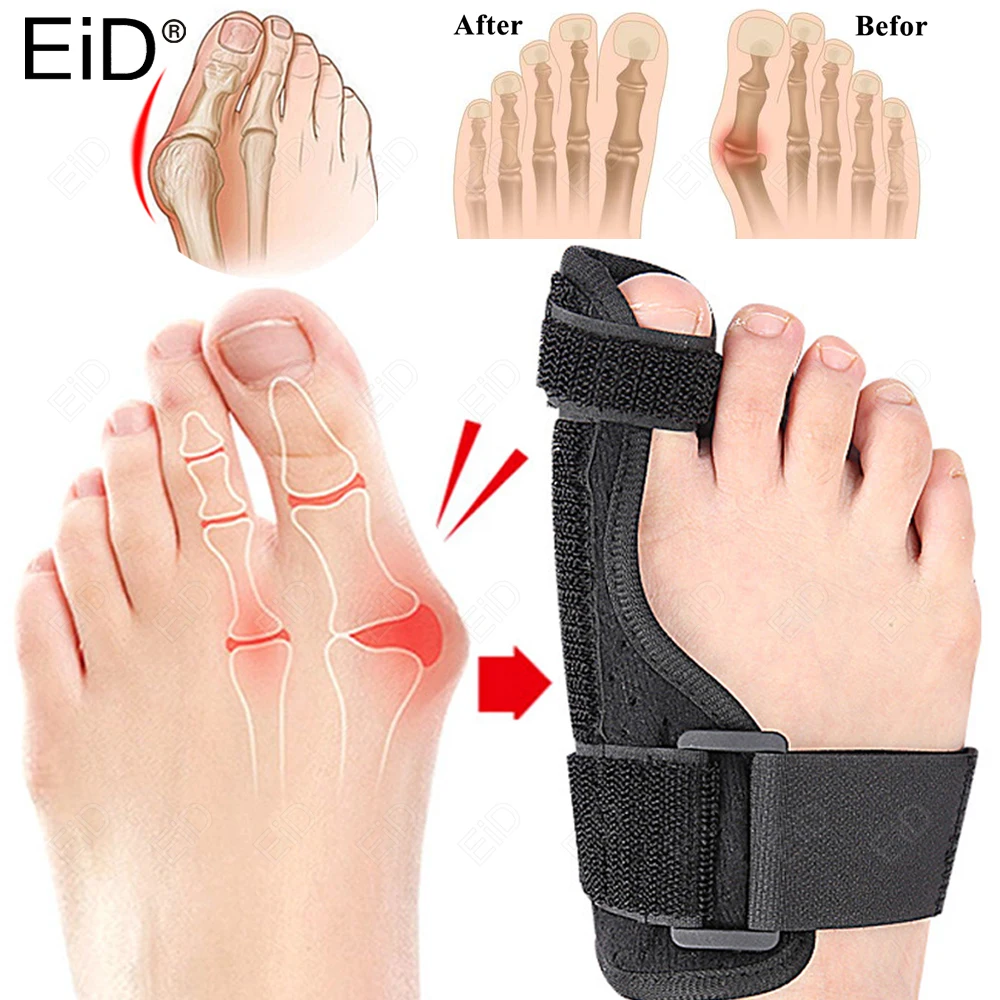 

Toe Bunion Splint Corrector Big Toe Hallux Valgus Straighteners Bunion Feet Care Thumb Adjuster Correction Bandage Pain Relieve