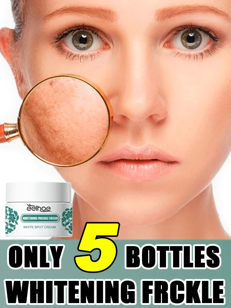 

Removal Freckles Dark Spots Brighten Facial Skin Firming Whitening Frckle Products Reduce Melanin