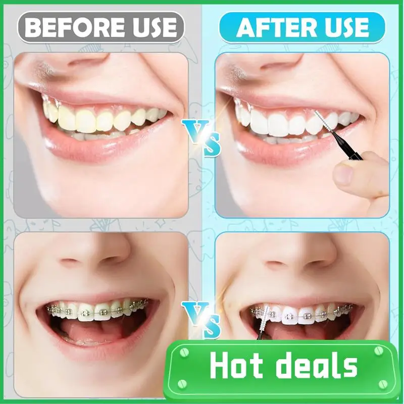 

A74X-120Pcs Interdental Brushes, Braces Brush Cleaner For Teeth Cleaning Tools Spiral Brush For Efficient Oral Care