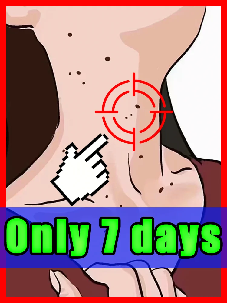 2025년 사마귀를 위한 신제품, 사마귀로 인한 불편을 줄여주는 바디 도구, 무료 배송, 남녀공용