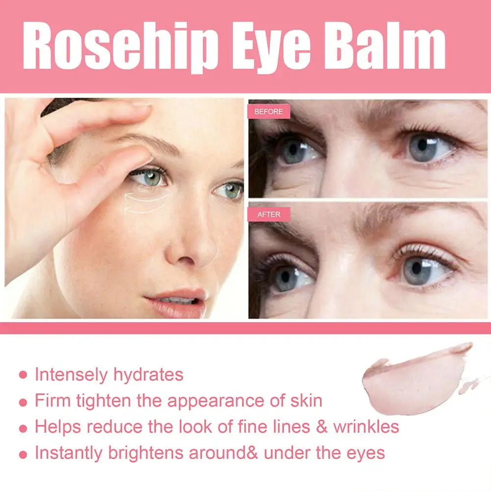 3g Rosehip Eye Balm Smooth Skin Improve Dark Circles Puffiness Fade Fine Lines Lifting Tightend Moisturizing Nourish Eye Skin