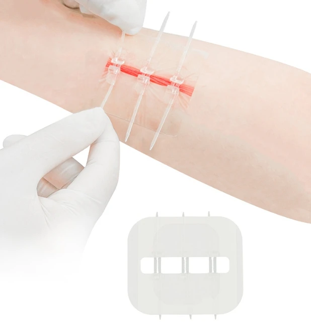 Zip-tension Reducing Tape Needle-free Stitching Tape body surface Wound Tape Pull And Close Band-aid