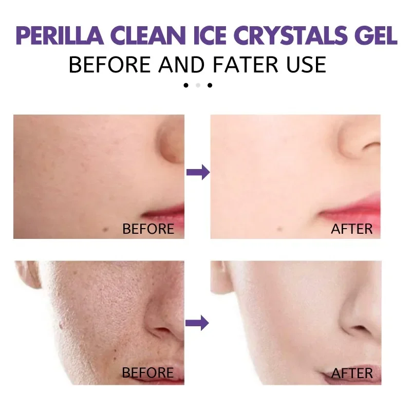 Perilla Clean Ice Crystals Gel Gentle Sooth Repair Cleaning Pores Shrink Acne Dark Spot Refresh Moisturizing Whitening Skin Gel