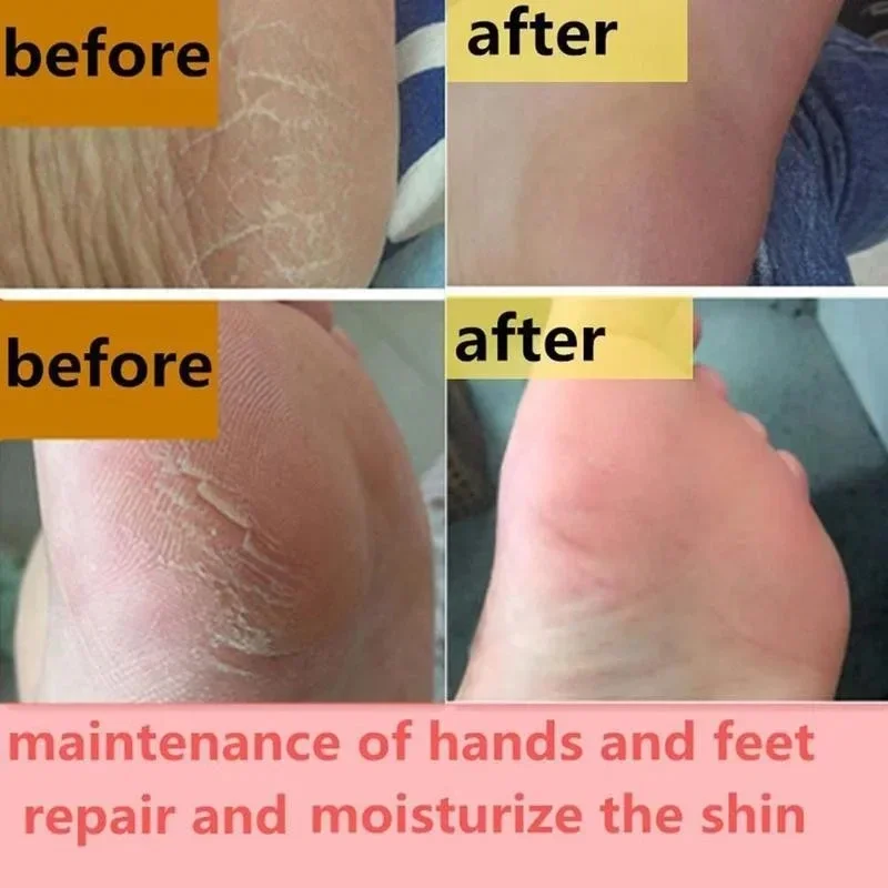 Moisturizing Anti-Drying Crack Foot Cream 30g Hand Feet Care For Family Exfoliation Dead Skin Removal Soften Smooth Skin Cream