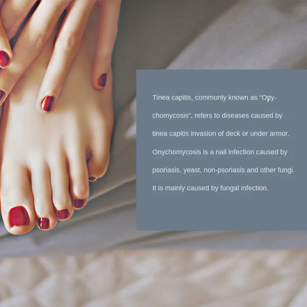 Neue Reinigung Laser Gerät Wiederaufladbare Nagel Pilz Nagel Behandlung Entfernen Entferner Werkzeug