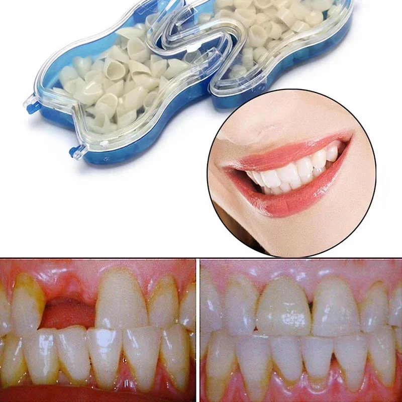 

60PCS Temporary Denture Braces Occlude Upper Dentures Veneer Dentures Missing Teeth Broken Teeth