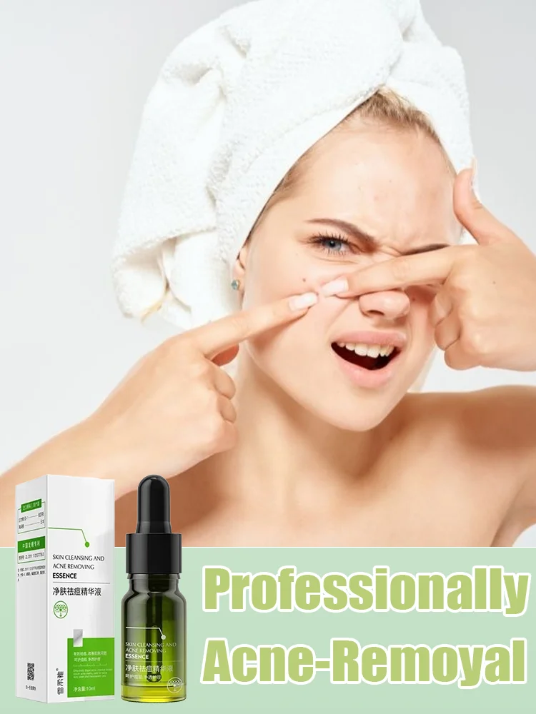 

Anti Acne Face Serum Moisturizing Salicylic Acid Pimple Scar Blackhead Removal Shrink Pores Oil Control Acne Treatment Skin Care