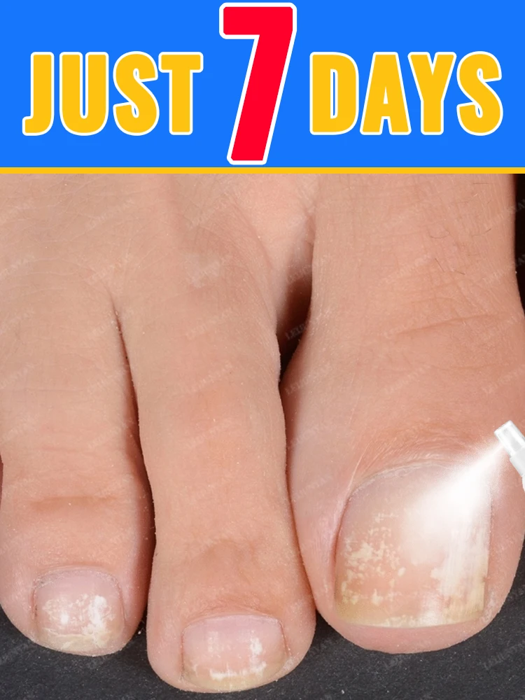 

Spray for beautiful nails