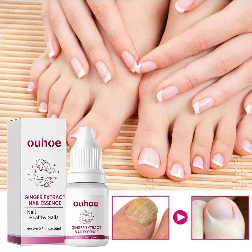 OUHOE 10ml Ginger Nail Essence Nourishing Rough Nails Anti Paronychia Nail Fungal Nail Treatment Essence Hand Foot Care