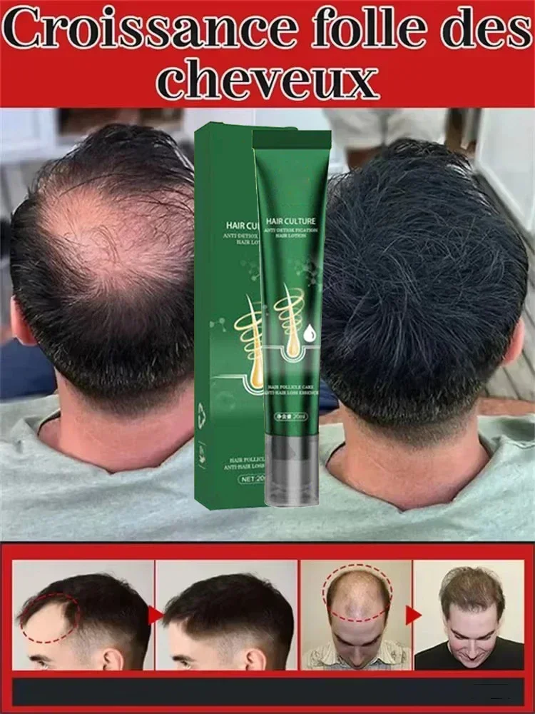 

2025 Biotin Fast Hair Growth Oil aHair Regrowth Serum aHair Thinning Treatment aHair Growth Liquid Anti-Hair Loss for Women&Men