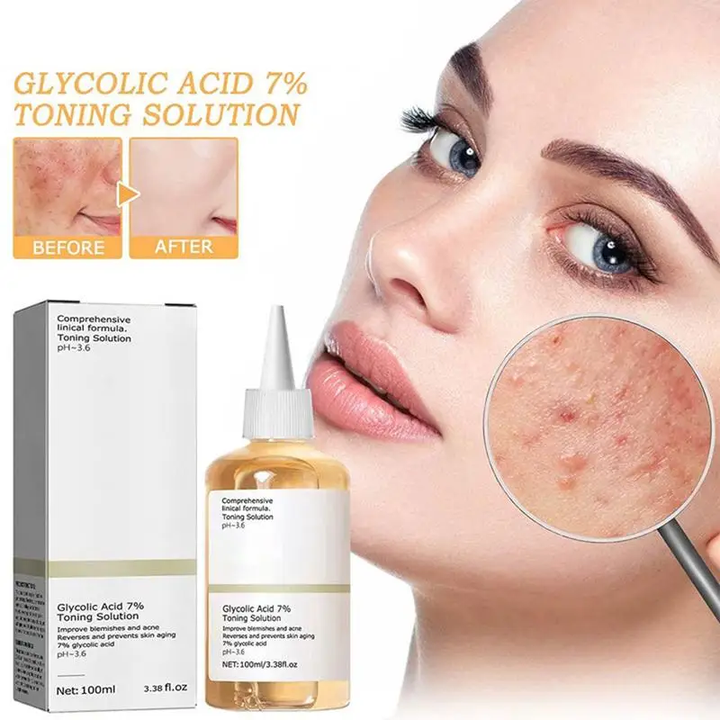 Toner entfernen Akne verblassen Akne Glykol säure 7% Markierungen verbessern die Haut feuchtigkeit spendende Bleaching befeuchten Toning gewöhnliche Original produkte