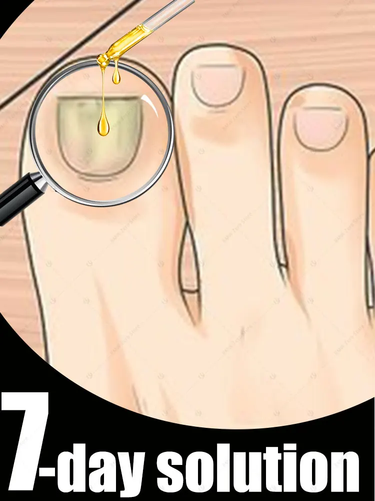 Los parches de uñas más vendidos de 2025 son herramientas translúcidas y brillantes.