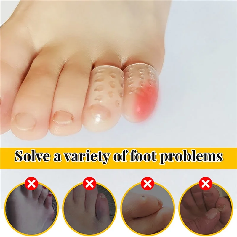 1/20Pcs Silicone Toe Protective Cover Anti-Friction Breathable Protector Prevents Blisters Toe Caps Covers Protectors Foot Care