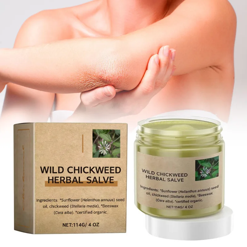 

114g Wild Chicken Grass Herbal Cream Moisturizes and Soothes Dry Skin for Skin Nourishment