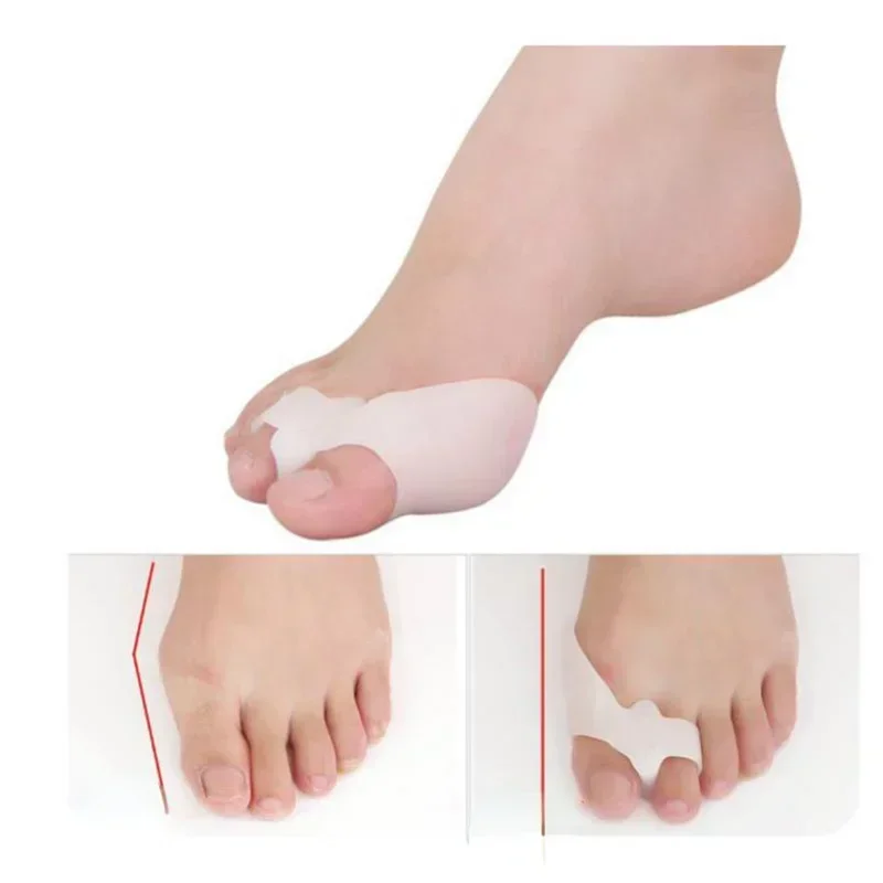 1Pair Silicone Gel Foot Fingers Two Hole Toe Separator Thumb Valgus Protector Bunion Adjuster Hallux Valgus Guard Feet Care