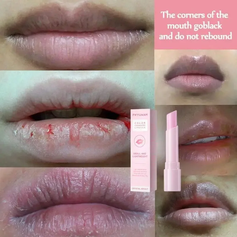 Lippen Roze Crème Verse Bleekbehandeling Verwijderen Donkere Rook Lippen Lippenbalsem Whitening Hydraterende Serum Verdunde Melanine Lipverzorging