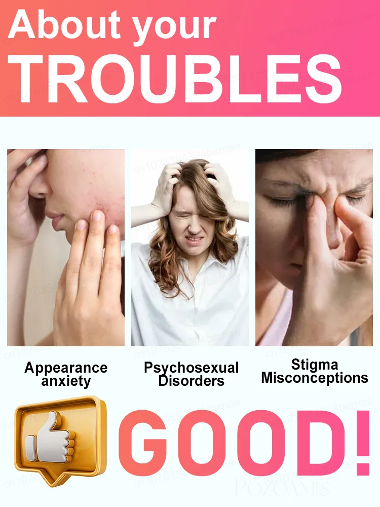 ʙʟᴜᴇ ʟɪɢʜᴛ ᴘᴇɴ sᴏʟᴠᴇ ᴡᴀʀᴛs, ʜᴏᴛ sᴀʟᴇ ᴡᴀʀᴛ ᴄᴀʀᴇ ᴛᴏᴏʟs