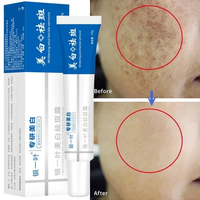 Effective Whitening Spot Cream Remove Melasma Dark Spot Cream Whiten Smooth Fading Melanin Moisturising Beauty Facial Skincare ﻿