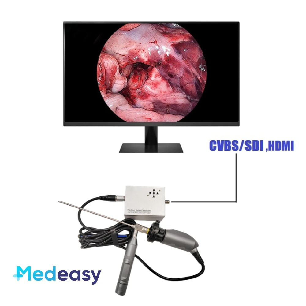 Imagem -06 - Ent Médica Portátil Endoscópio Câmera Unidade Full hd