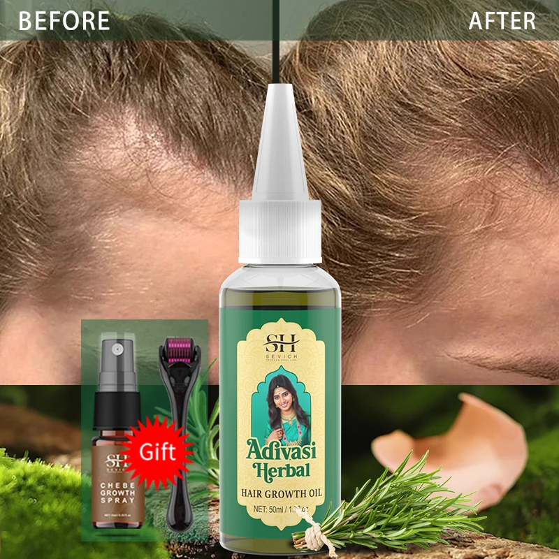 

50ml Original India Oil Adivasi Herbal Hair Oil Rosemary Hair Growth Oil For Men Ayurvedic Anti Hair Loss Regrowth Thicken Oils