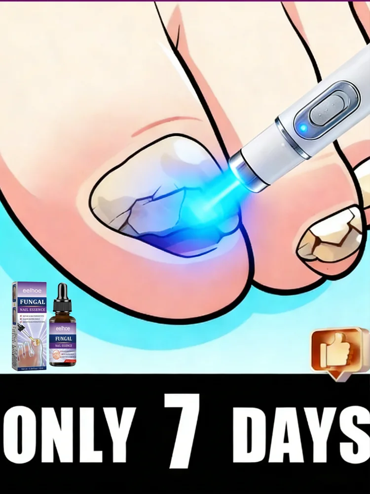 

Новый лазерный карандаш 2026HT для очистки ногтей, инструменты для маникюра с синим светом, лазерный аппарат для ухода за ногтями