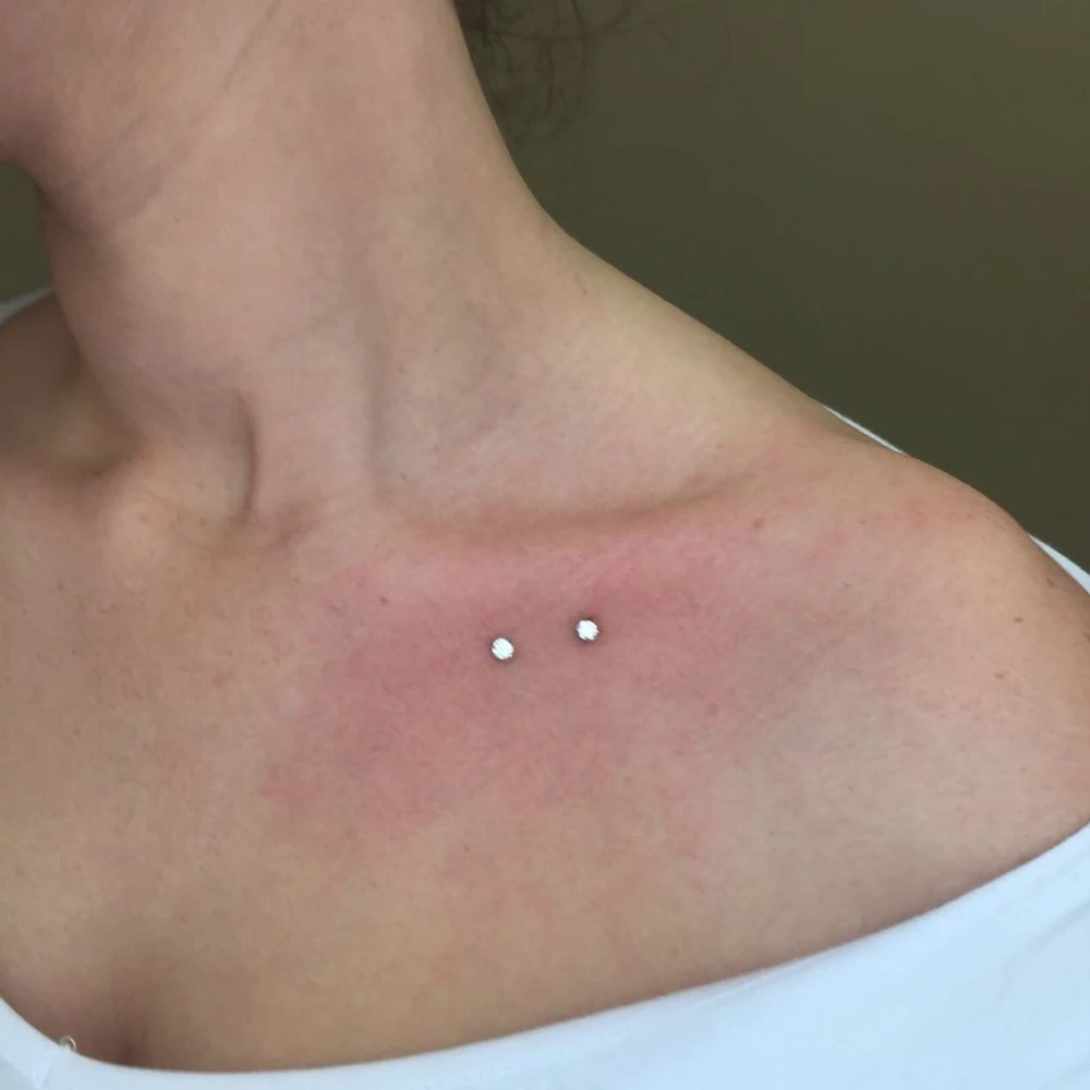 G23 Titanium Surface Piercing Double Ball Dermal Anchor