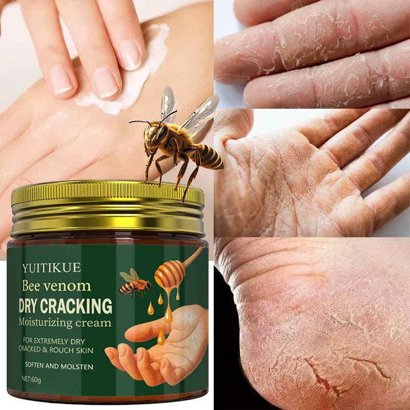 Bee Venom Repair Cream 60g - Intensive Repair for Severely Dry & Cracked Hands/Feet, Fast Absorption, Non-Greasy Formula