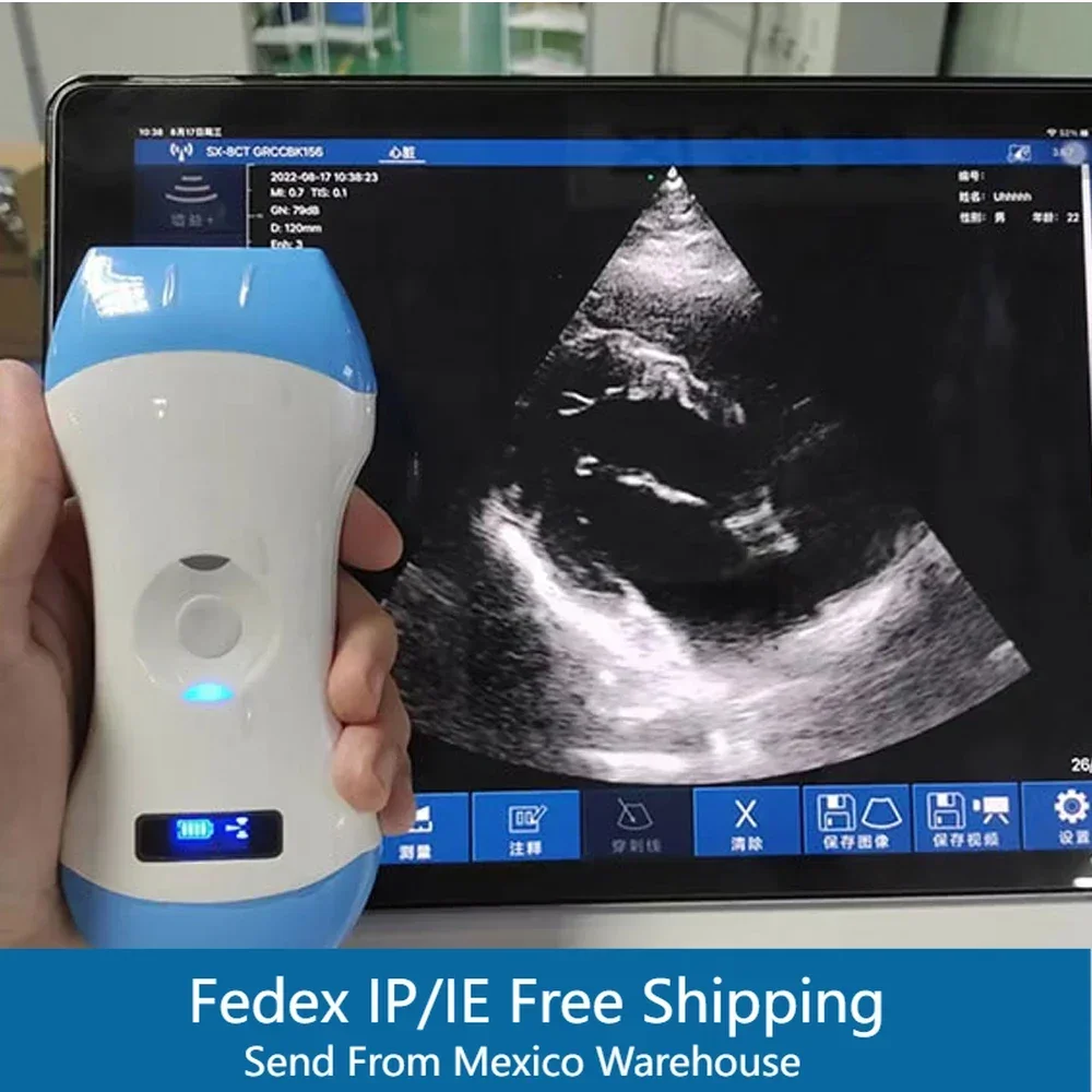 Ultrasound Portable Medical Wireless Ultrasound Scanner Machine Support IOS Android Windows