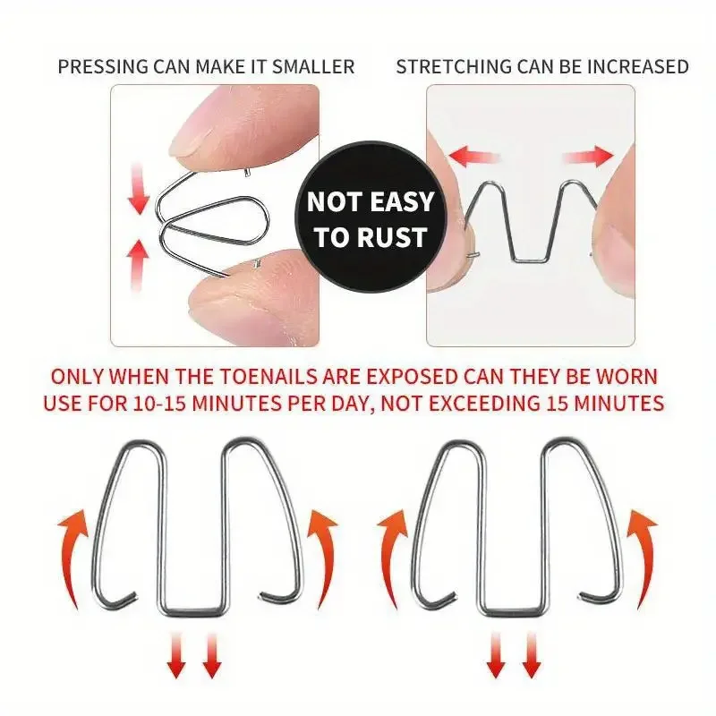 ชุดเครื่องมือแก้ไขเล็บข้อเท้าเกิดจากเล็บงอกขึ้น 6 ชิ้น พร้อมที่รัดเล็บ/ยางรัดสำหรับยืดเล็บ รักษาโรคเล็บข้อเท้าอักเสบ และทำเล็บเท้า
