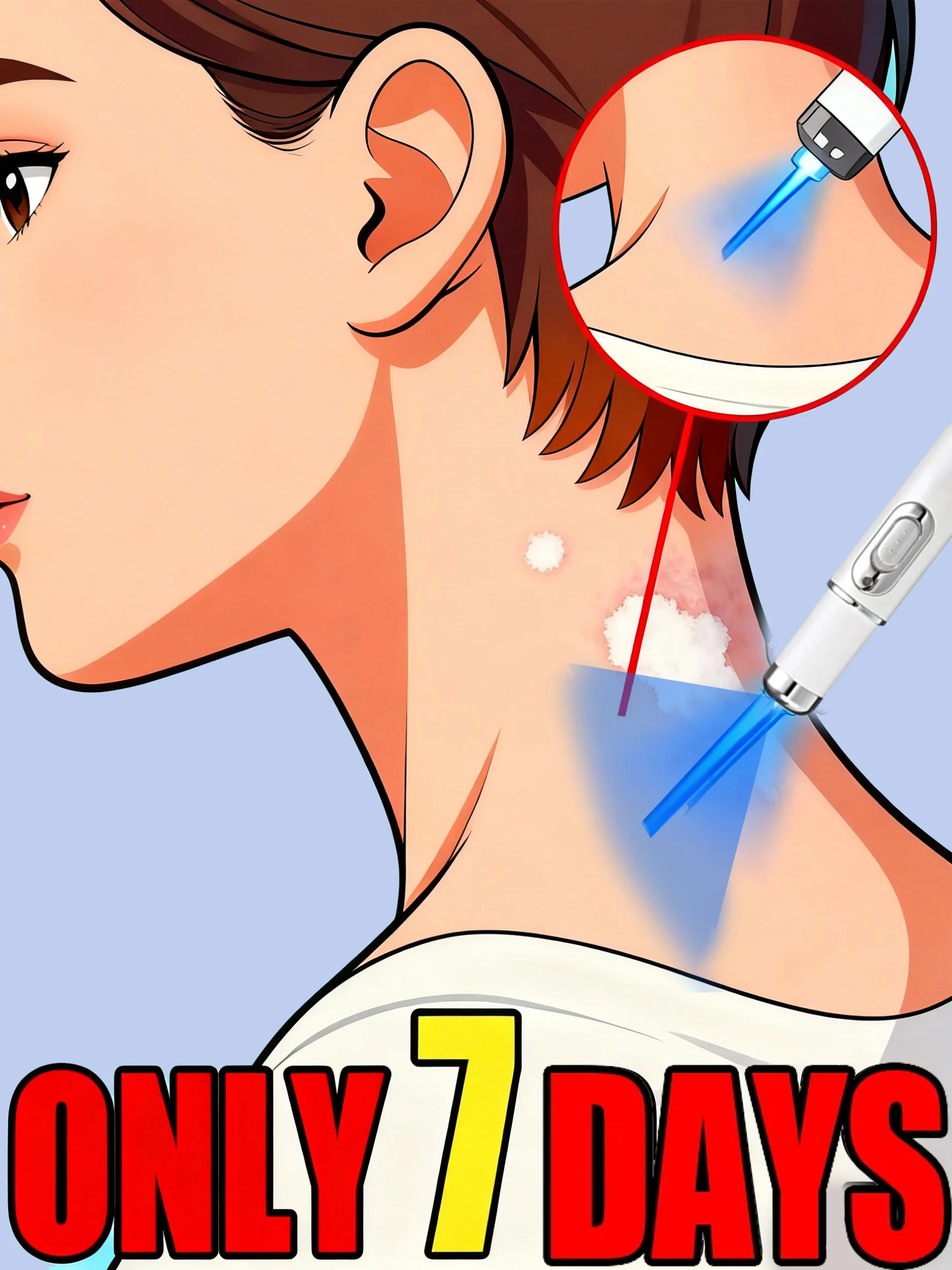 

Latest upgraded blue light pen home use Gentle Solve White spots care laser pointer Skin care tools