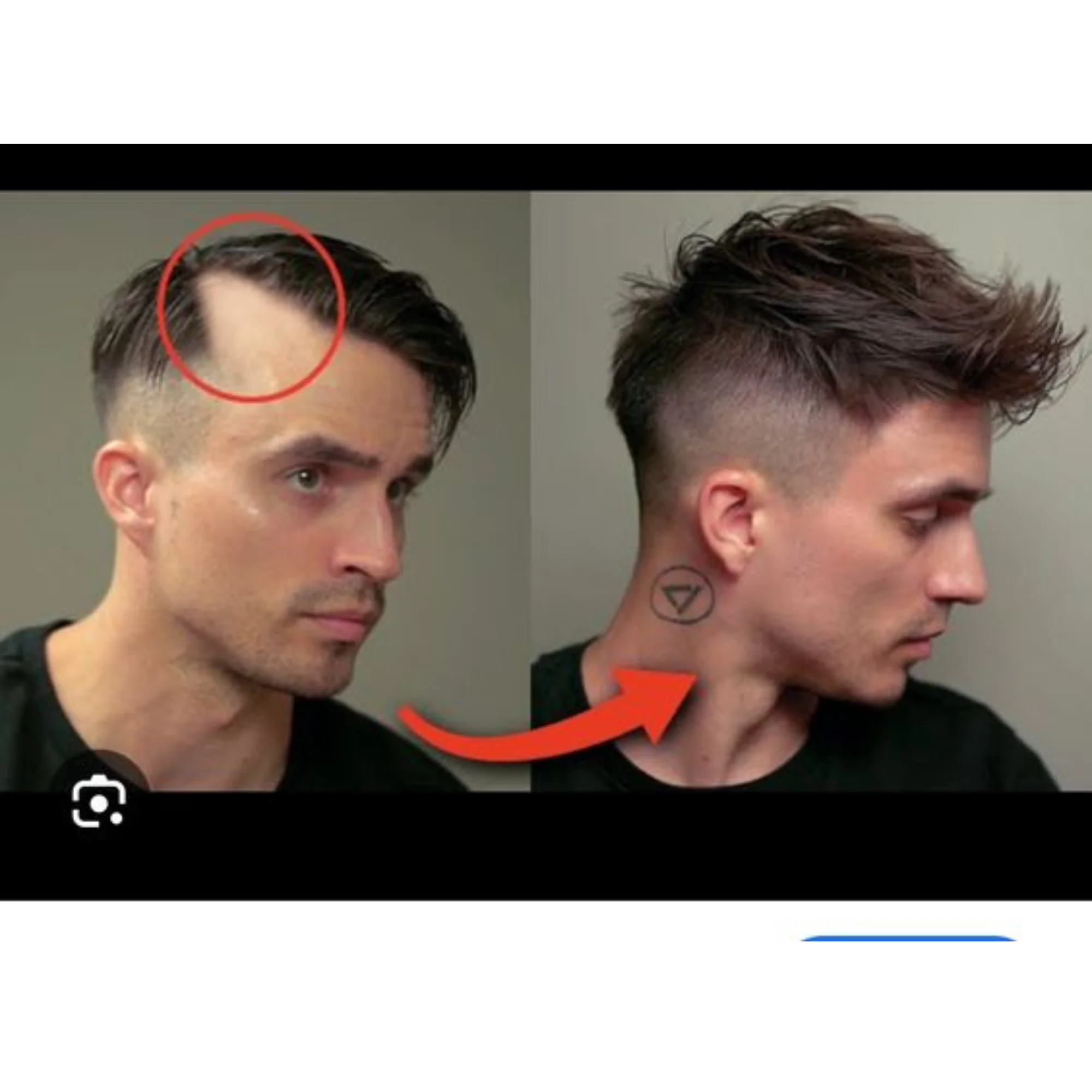 OCK 1 paar Menselijk Haar Vervanging Patch voor Mannen 15 cm Haarlijn Verlies Rechte Tape in Vervanging Toupetje