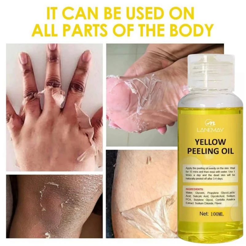 Óleo de peeling amarelo para pele escura, clarear loção, clarear corpo, cotovelo, joelho, mão, esfoliar, pele morta nutrir, mesmo tom de pele, alvejante, forte