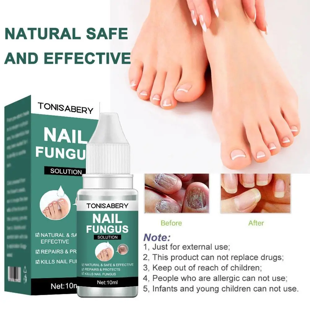 Loção do reparo do fungo do prego, Essência do cuidado dos pés, Anti Toe Paronychia Removal, Gel de onicomicose, Infecção do prego, 10ml, M2H6