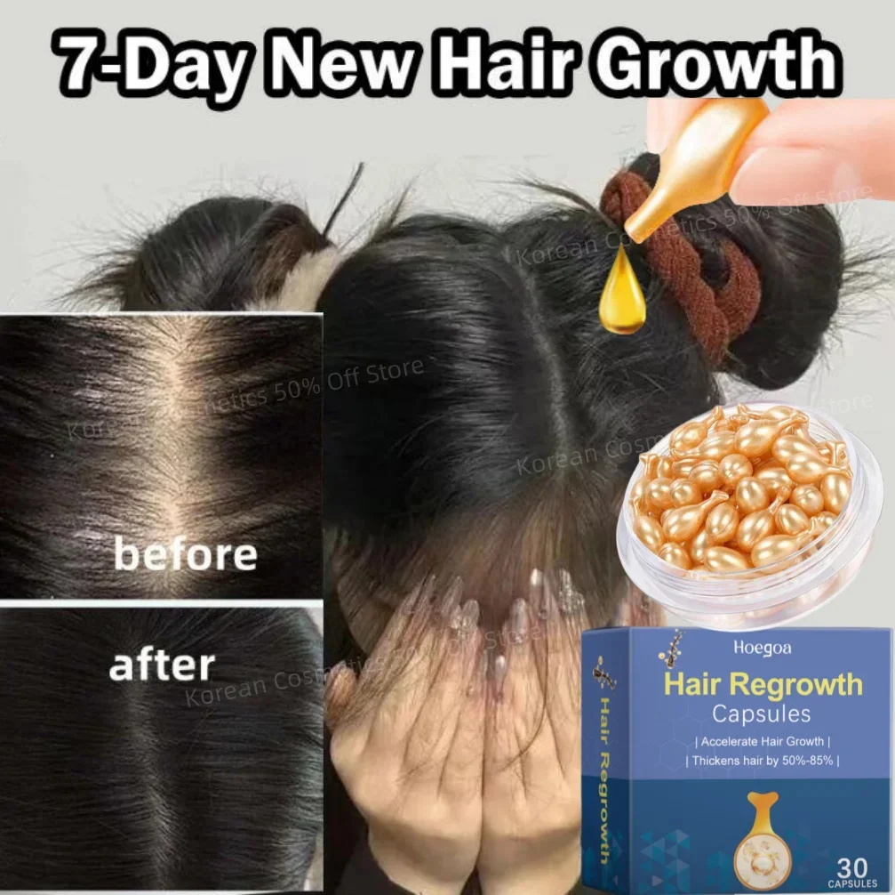 

Hair Growth Serum 7 Days Fast Regrowth Essential Capsule Anti Hair loss Baldness Repair Damaged Scalp Treatment For Women Men